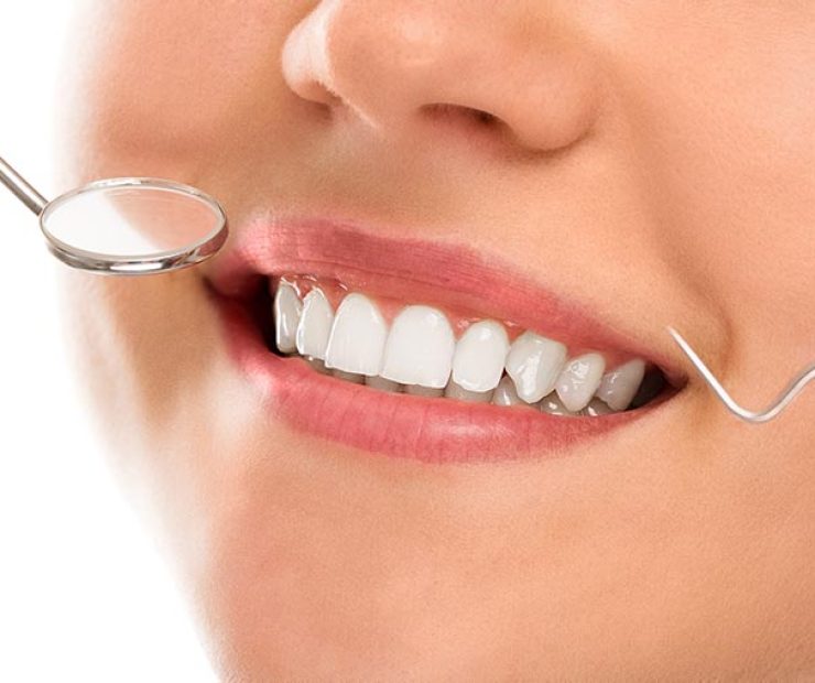 A woman is smiling while being at the dentist