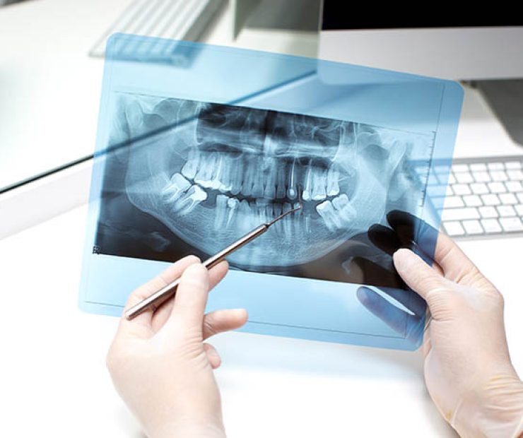 dentist analyzes x ray photo