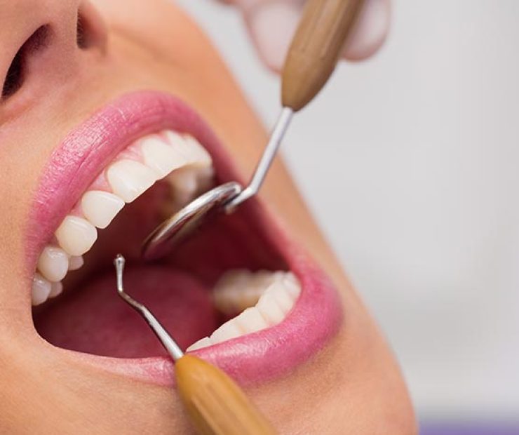 Close up of dentist examining female patient teeth