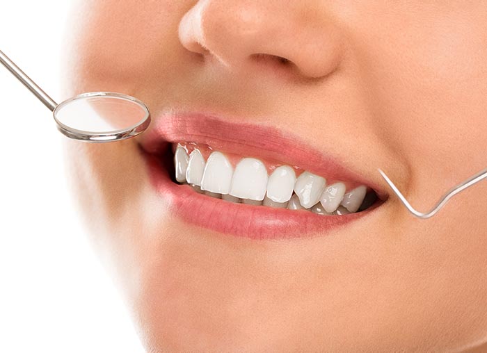 A woman is smiling while being at the dentist